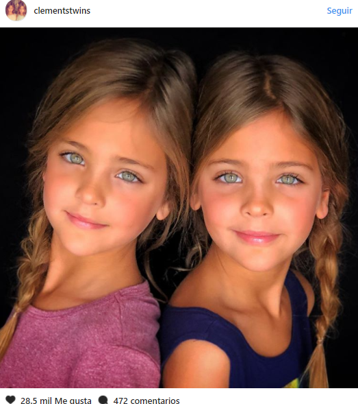 Ces Jumeaux Identiques Nes En 07 Ont Grandi Et Ont Ete Choisis Comme Les Plus Beaux Jumeaux Du Monde Entier Un Jour De Reve Ces Jumeaux Identiques Nes En 07 Ont Grandi Et Ont Ete Choisis Comme Les Plus Beaux Jumeaux Du Monde Entier Un Jour De Reve