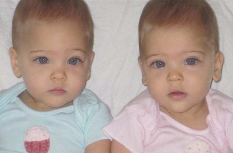 Ces Jumeaux Identiques Nes En 07 Ont Grandi Et Ont Ete Choisis Comme Les Plus Beaux Jumeaux Du Monde Entier Un Jour De Reve