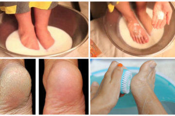 Dont Spend Your Money on Pedicure Use Two Ingredients From Your Kitchen and Make Your FEET Look Nice 696x391