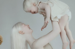 albino sisters photoshoot kazakhstan asel kalaganova fb7